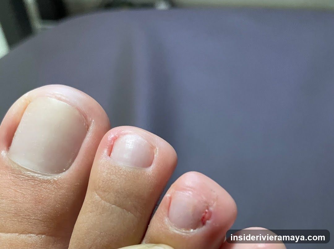 Close-up of toes with nail damage