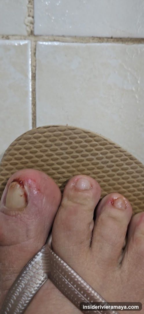 Injured Foot