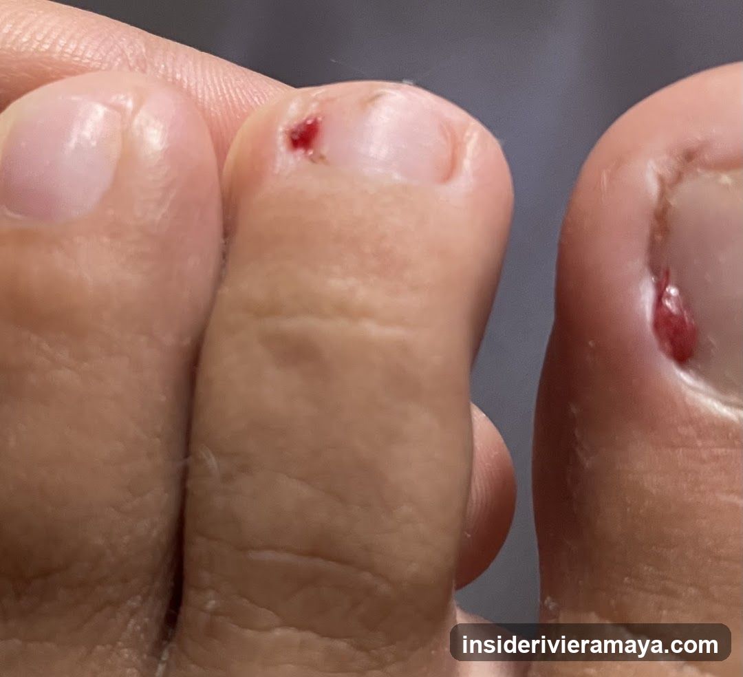 Close-up of toes with injuries