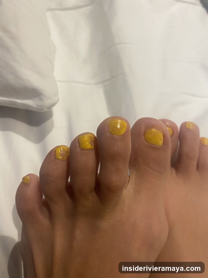 Yellow Painted Toenails